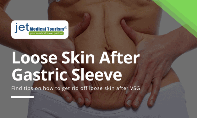 Loose Skin After Gastric Sleeve