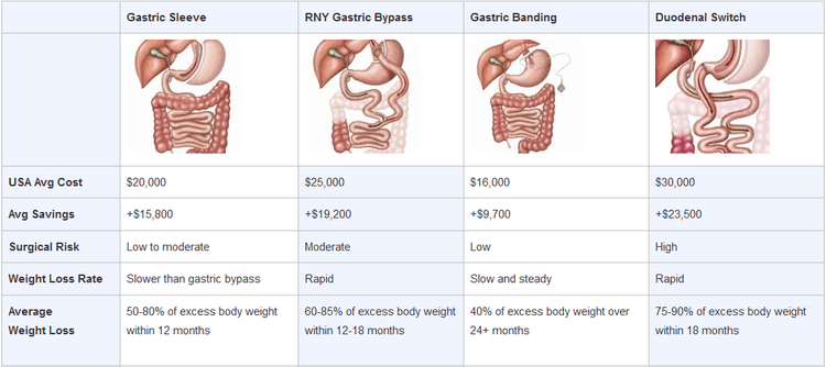 Weight Loss Surgery Procedures Types Of Bariatric Surgery