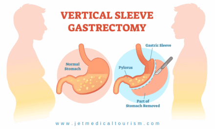 Pros And Cons of Gastric Sleeve Surgery | Gastric Sleeve Benefits & Risks