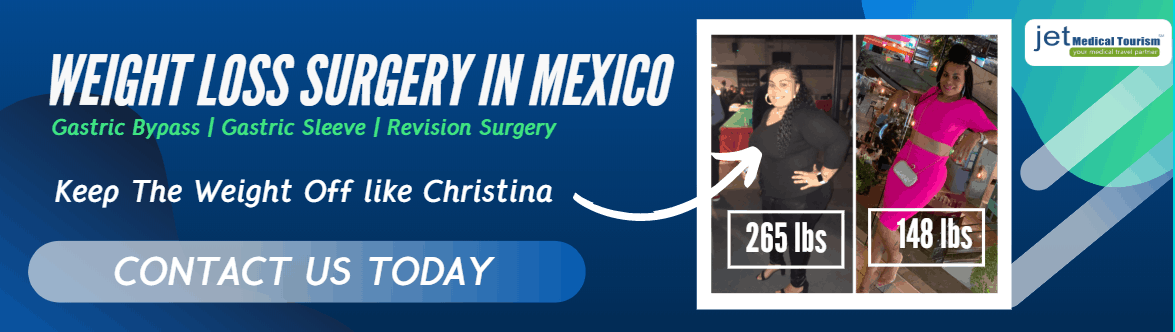 weight loss surgery in mexico