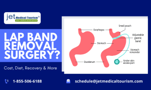 Lap Band Removal Surgery | Lap Band Removal Cost & Recovery