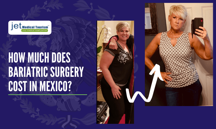 Weight Loss Surgery Cost In Mexico Jet Medical Tourism