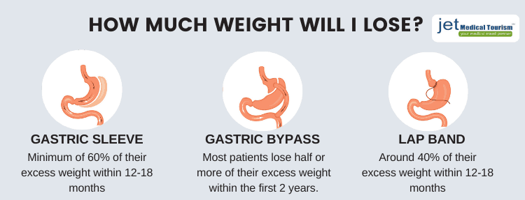 Why is Gastric Band No More Preferred? Look at the Alternatives