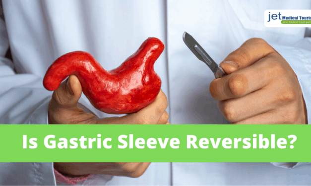 Is Gastric Sleeve Reversible?