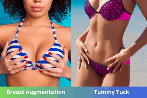 Aumento de senos y abdominoplastia