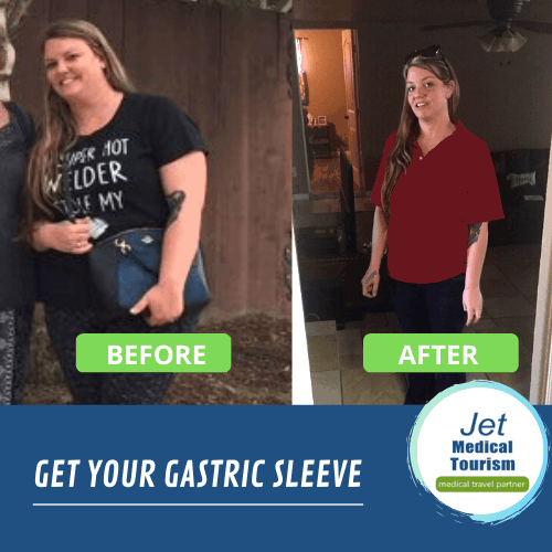 This inspiring Gastric Sleeve Before and After Story shares Meagan's gastric sleeve journey.