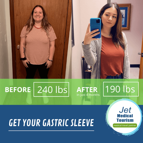 Samantha's VSG Success Story shows 50 lbs of weight loss in only 3.5 months. 