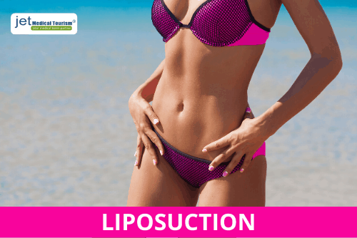 Liposuction Guadalajara