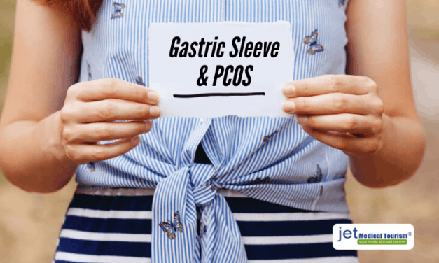 Gastric Sleeve And PCOS: Everything You Need to Know