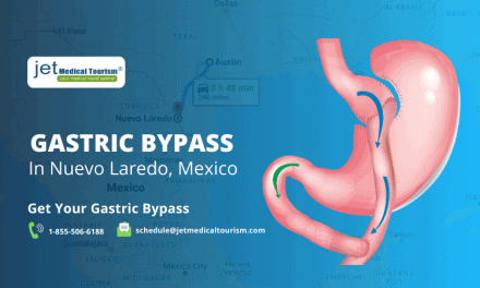 Gastric Bypass Nuevo Laredo, Mexico
