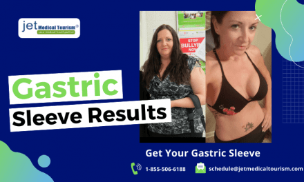 Gastric Sleeve Failure Can A Gastric Sleeve Be Redone