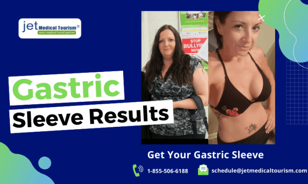Gastric Sleeve Results: Expected Weight Loss After VSG Surgery