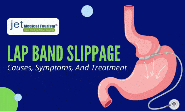 Lap Band Slippage: Causes, Symptoms, And Treatment