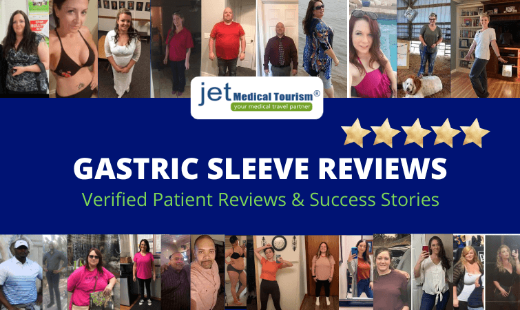 Gastric Sleeve Reviews