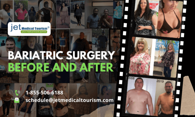 Bariatric Surgery Before And After