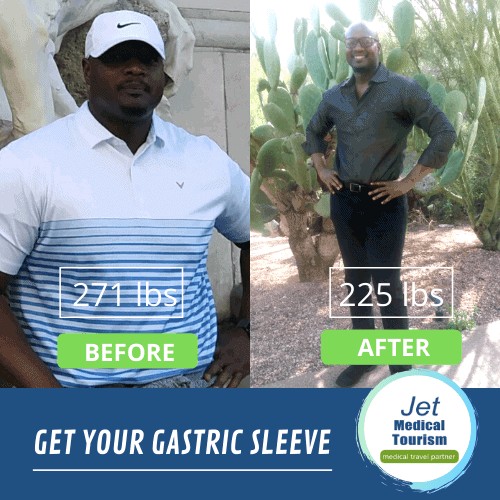 Best Male Gastric Sleeve Before and after Picture