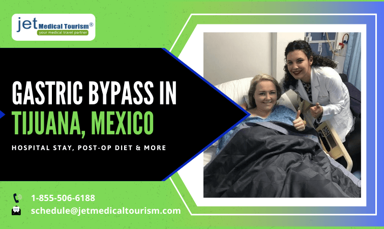 Gastric Bypass Mexico Roux En Y Gastric Bypass Rny Tijuana 5499