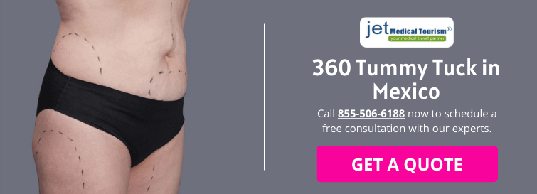 360 Tummy Tuck Mexico