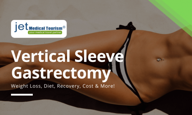 Vertical Sleeve Gastrectomy Procedure: Cost, Diet, Recovery, Success Stories