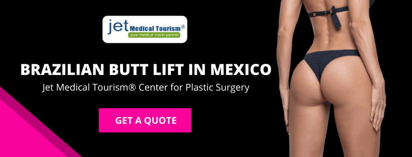 Brazilian Butt Lift in Mexico