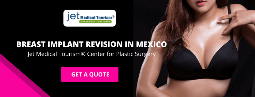 Breast Implant Revision in Mexico