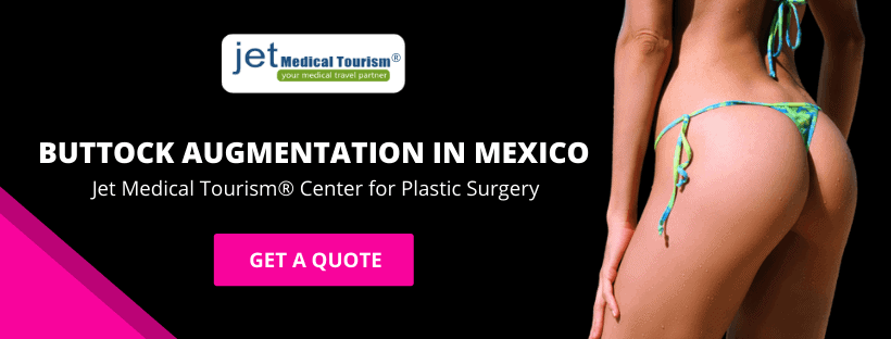 Buttock Augmentation in Mexico