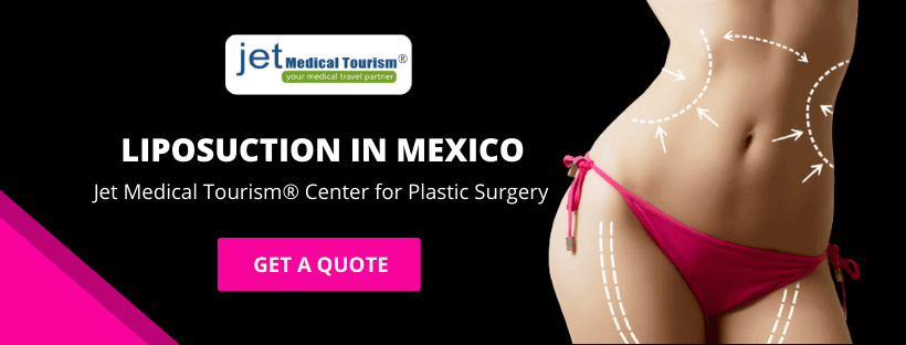 Liposuction in Mexico