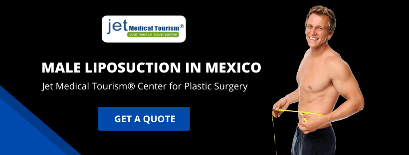 Male Liposuction in Mexico