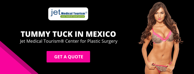 Tummy Tuck in Mexico (Abdominoplasty)