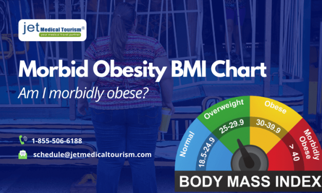 Morbid obesity BMI chart: Am I morbidly obese?