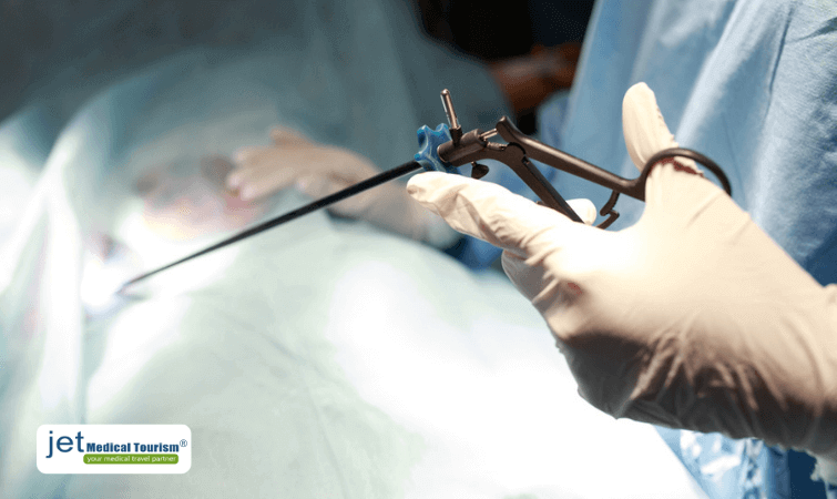 Single incision gastric sleeve in Mexico