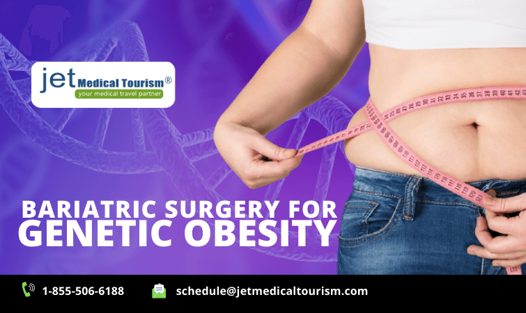 https://jetmedicaltourism.com/wp-content/uploads/2020/11/Bariatric-Surgery-for-Genetic-Obesity.png