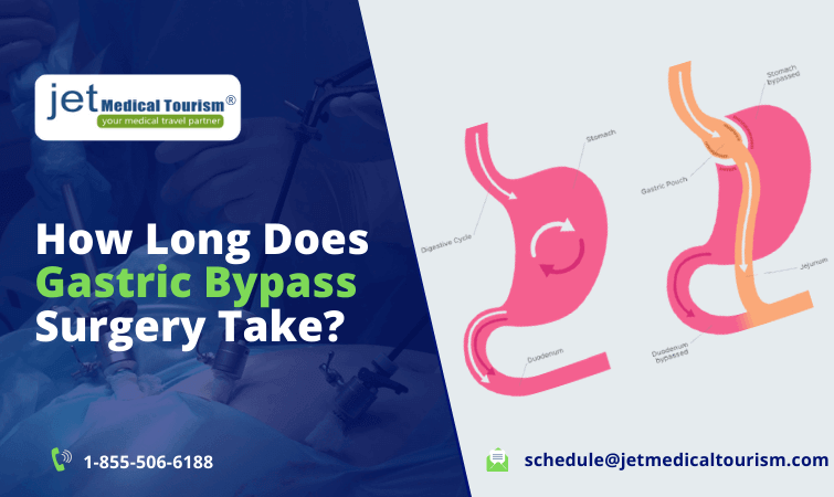 How Long Does Gastric Bypass Surgery Take Jet Medical