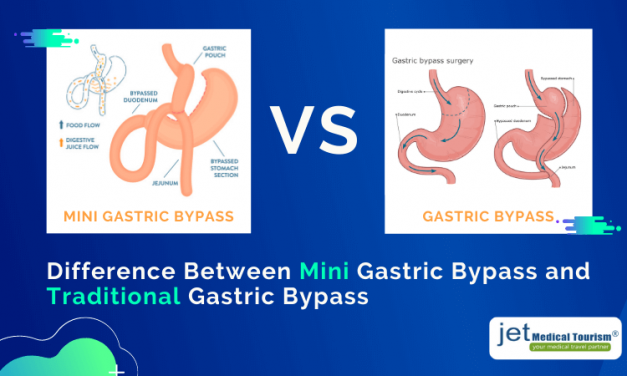 Mini Gastric Bypass vs Gastric Bypass