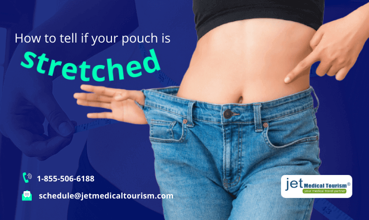 How to tell if your pouch is stretched