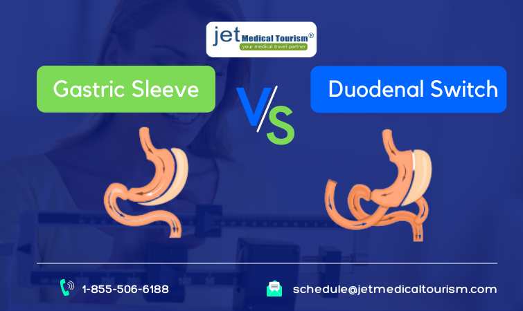 Gastric Sleeve vs. Duodenal Switch Comparison