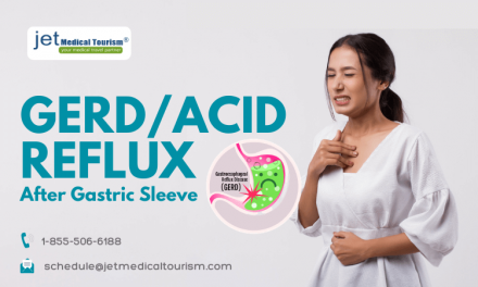 Acid Reflux or GERD After Gastric Sleeve