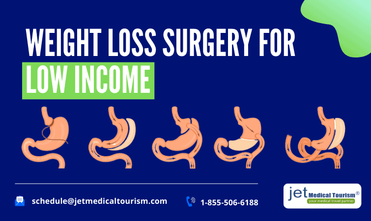 Weight Loss Surgery for Low Income