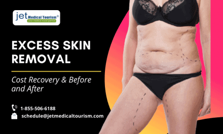 Excess Skin Removal: Cost, Recovery & Before, And After