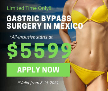 Gastric Bypass in Mexico - Jet Medical Tourism®