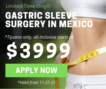 Gastric Sleeve Surgery in Tijuana Mexico