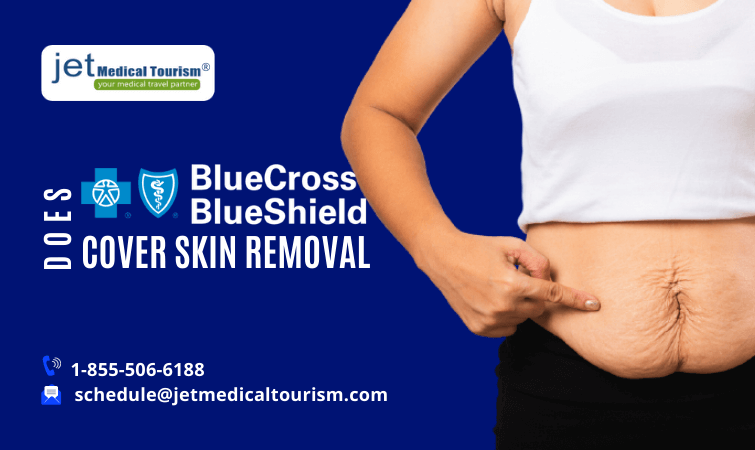 Does Blue Cross Blue Shield Cover Skin Removal