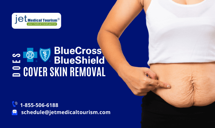 Does Blue Cross Blue Shield Cover Skin Removal - Jet Medical ...