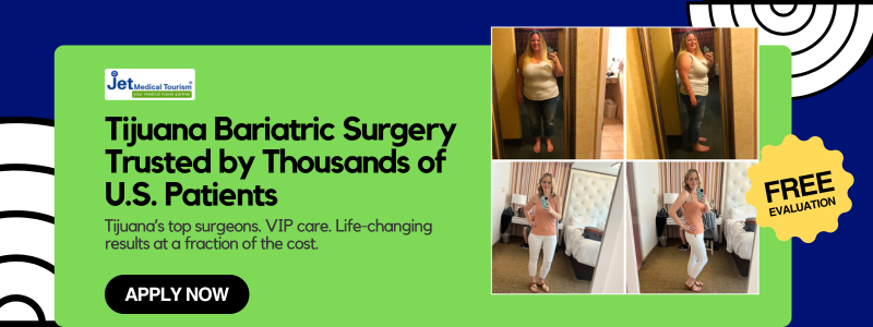 Tijuana Bariatric Surgery Free Quote