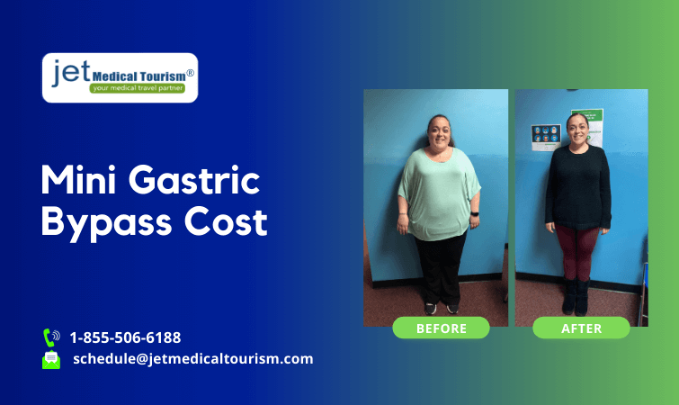 Cost of Mini Gastric Bypass