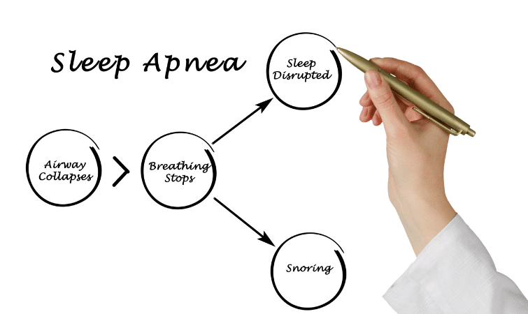 Sleep Apnea Effects