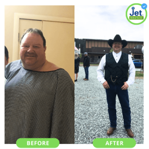 Gastric Sleeve Before and After Pictures: Best VSG Photos (2023)