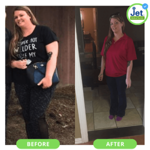 Gastric Sleeve Before and After Pictures: Best VSG Photos (2023)