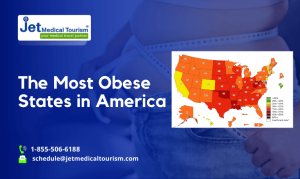 The Most Obese States in America 2025 - Jet Medical Tourism®