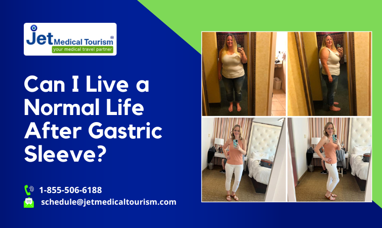 Can I Live a Normal Life After Gastric Sleeve?